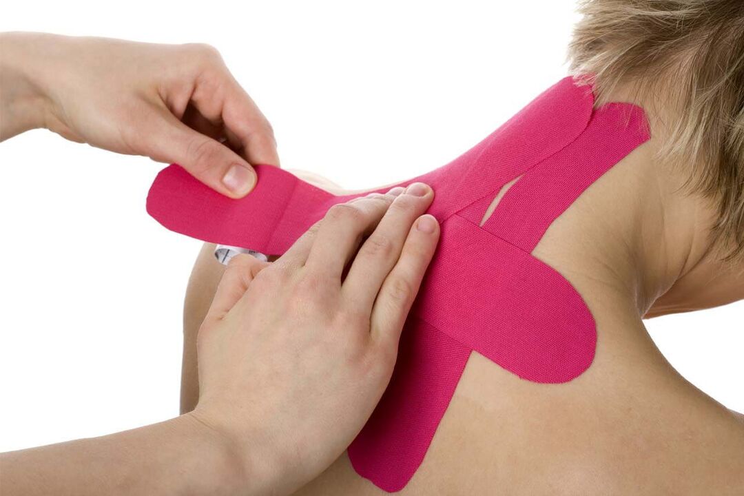 Nackentaping bei Osteochondrose